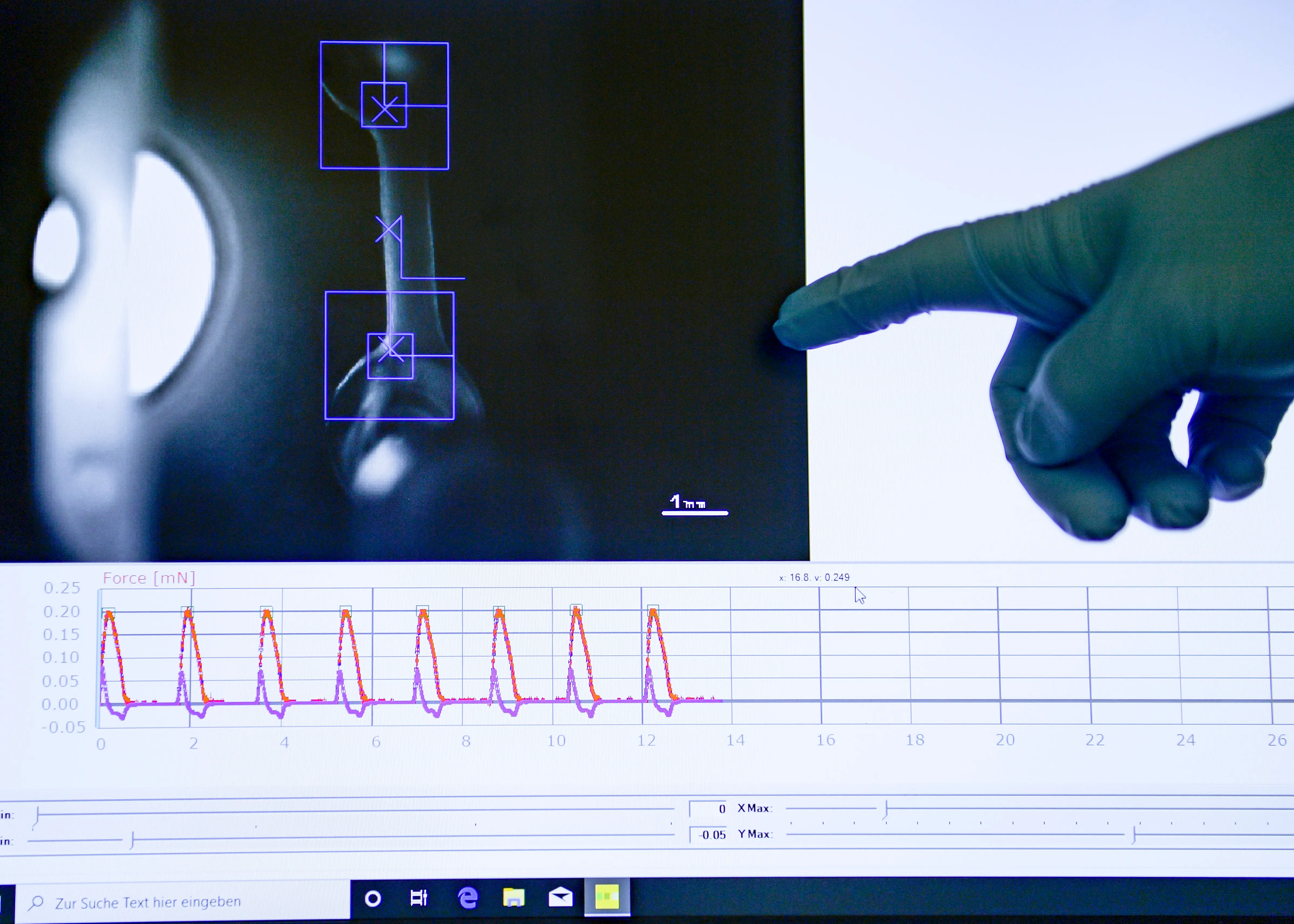 Shpat Kasapi was suffering from some minor heart problems over the years (Representative image via Getty)