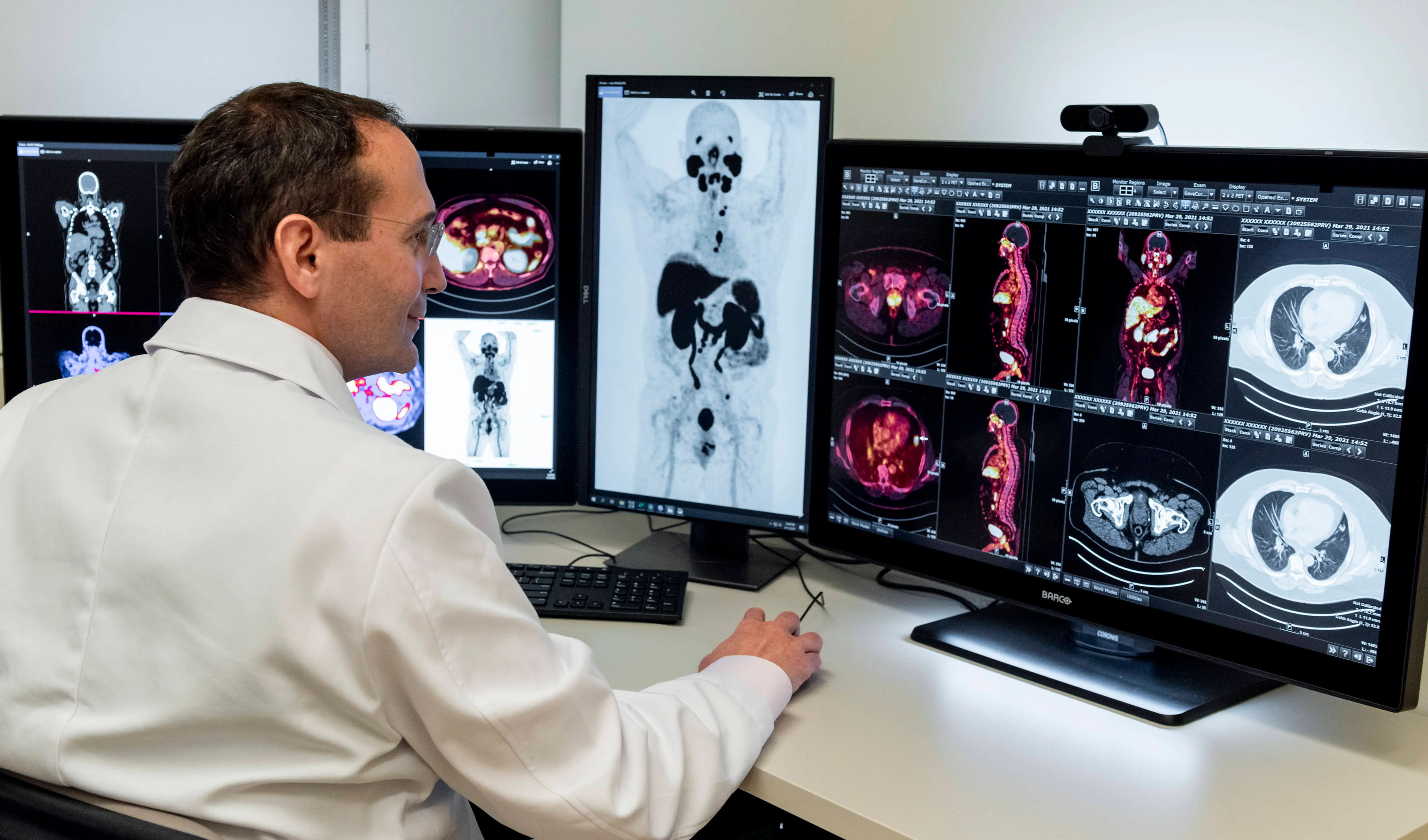 Dr. Gary Ulaner, director of the Hoag Molecular Imaging and Therapy Program in Irvine views positron emission tomography images (Photo for reference, Image via Getty)