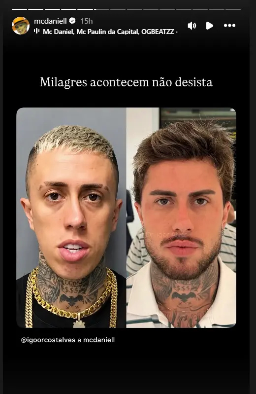 Before-and-after photos of Brazilian rapper MC Daniel go viral as ...