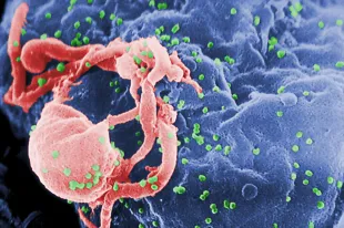 Mainly Mannie revealed the HIV diagnosis in a TikTok video (Image via Getty)
