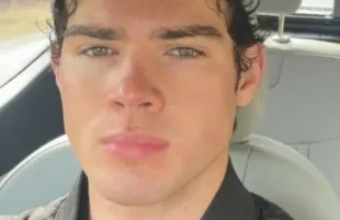 Kick streamer Clavicular injected fat dissolving peptides into his 17-year old girlfriend