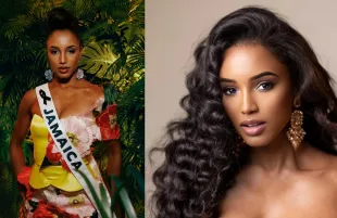 How is Miss Jamaica recovering after her stage fall? Details explored